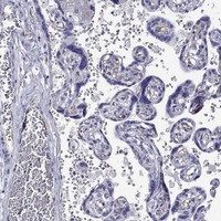 RTL1 Antibody in Immunohistochemistry (Paraffin) (IHC (P))