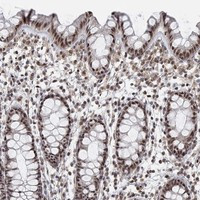 PWWP2B Antibody in Immunohistochemistry (Paraffin) (IHC (P))
