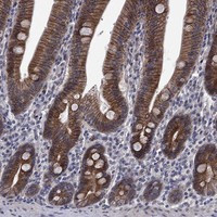 EMC9 Antibody in Immunohistochemistry (Paraffin) (IHC (P))