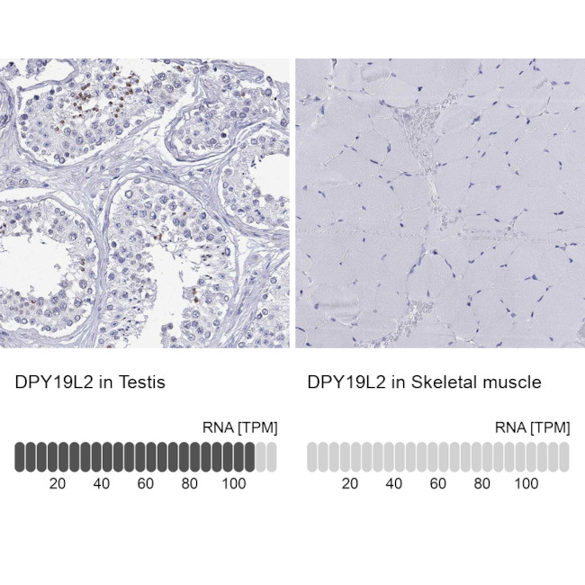 DPY19L2 Antibody in Immunohistochemistry (Paraffin) (IHC (P))