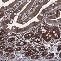 TMCO1 Antibody in Immunohistochemistry (Paraffin) (IHC (P))