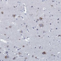 SLC45A1 Antibody in Immunohistochemistry (Paraffin) (IHC (P))