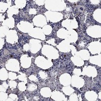 PPP2R5A Antibody in Immunohistochemistry (Paraffin) (IHC (P))
