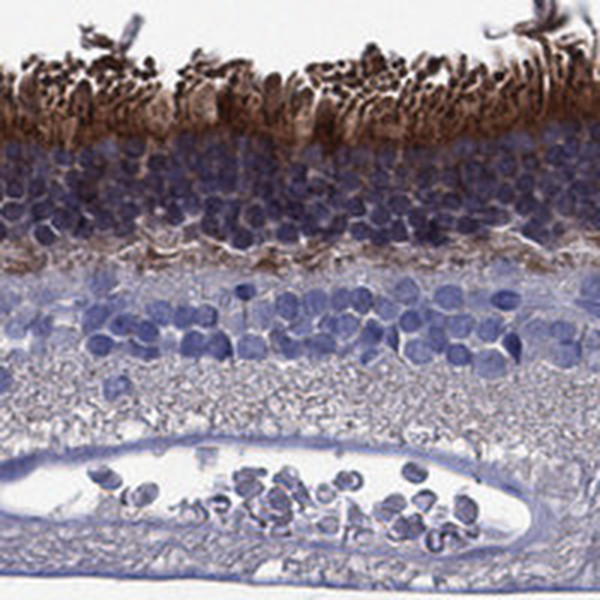 FSCN2 Antibody in Immunohistochemistry (Paraffin) (IHC (P))