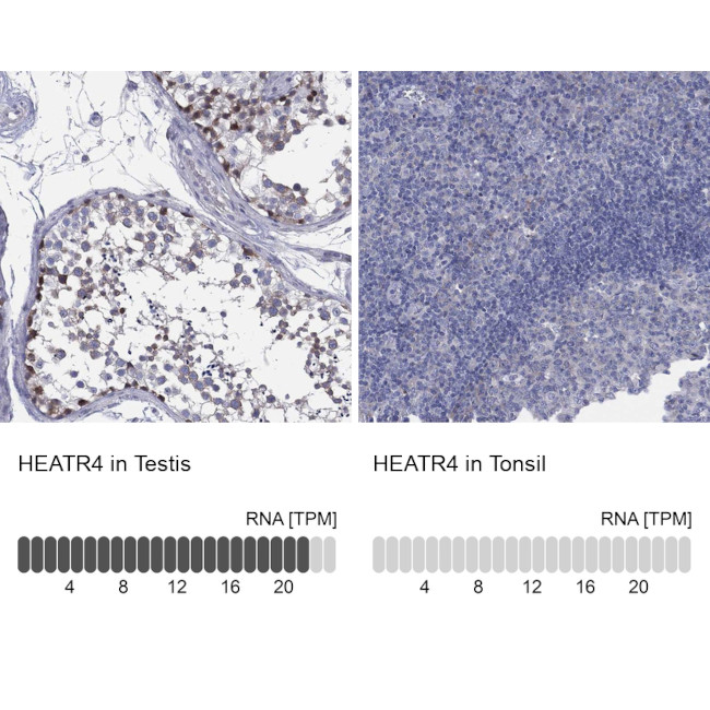 HEATR4 Antibody in Immunohistochemistry (Paraffin) (IHC (P))