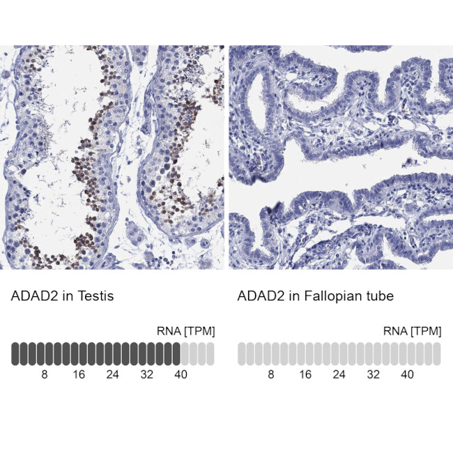 ADAD2 Antibody in Immunohistochemistry (Paraffin) (IHC (P))