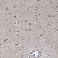PPP1R16B Antibody in Immunohistochemistry (Paraffin) (IHC (P))