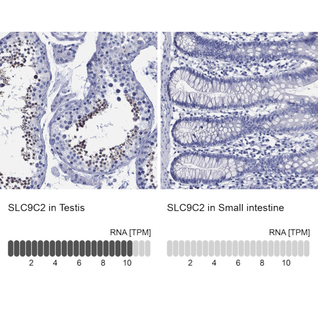SLC9A11 Antibody in Immunohistochemistry (Paraffin) (IHC (P))