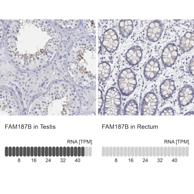 FAM187B Antibody in Immunohistochemistry (Paraffin) (IHC (P))