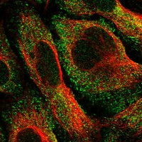CRYGA Antibody in Immunocytochemistry (ICC/IF)