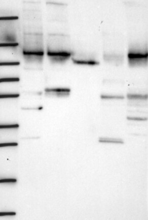 WDR3 Antibody in Western Blot (WB)