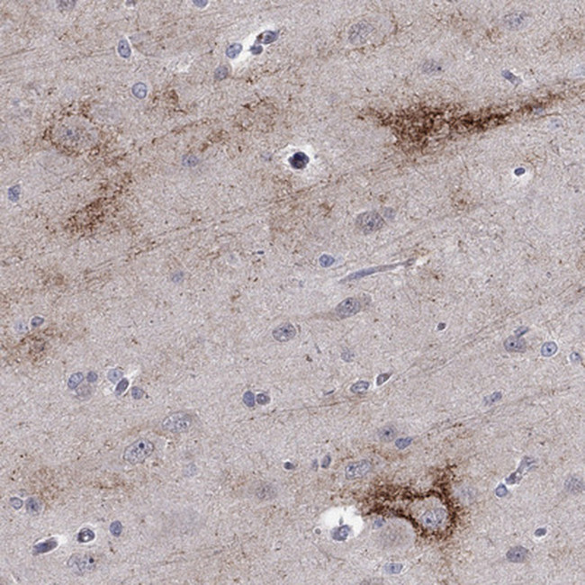 TTC21B Antibody in Immunohistochemistry (Paraffin) (IHC (P))