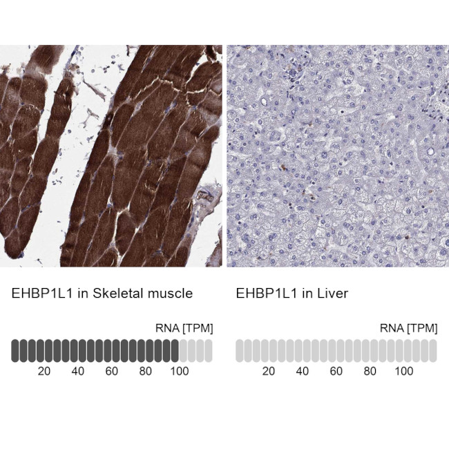EHBP1L1 Antibody in Immunohistochemistry (Paraffin) (IHC (P))