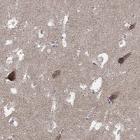 C9orf85 Antibody in Immunohistochemistry (Paraffin) (IHC (P))