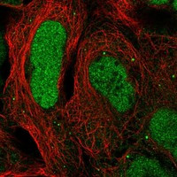 CAMTA2 Antibody in Immunocytochemistry (ICC/IF)