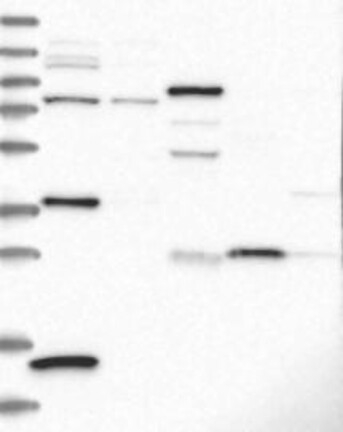 CRHBP Antibody in Western Blot (WB)