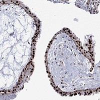GSE1 Antibody in Immunohistochemistry (Paraffin) (IHC (P))