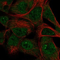 SKIV2L Antibody in Immunocytochemistry (ICC/IF)