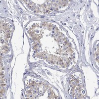 ANKMY1 Antibody in Immunohistochemistry (Paraffin) (IHC (P))
