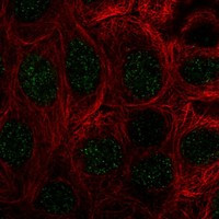 COMMD10 Antibody in Immunocytochemistry (ICC/IF)