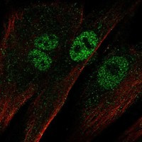 EBF2 Antibody in Immunocytochemistry (ICC/IF)