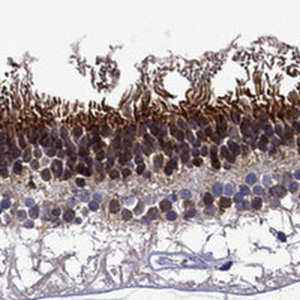 Spectrin beta-5 Antibody in Immunohistochemistry (Paraffin) (IHC (P))