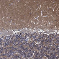 ZNF671 Antibody in Immunohistochemistry (Paraffin) (IHC (P))