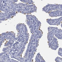 PPIL6 Antibody in Immunohistochemistry (Paraffin) (IHC (P))
