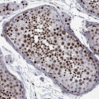 SURF2 Antibody in Immunohistochemistry (Paraffin) (IHC (P))