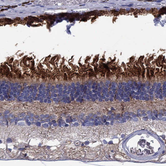 BCO2 Antibody in Immunohistochemistry (Paraffin) (IHC (P))