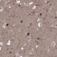 PLCL2 Antibody in Immunohistochemistry (Paraffin) (IHC (P))