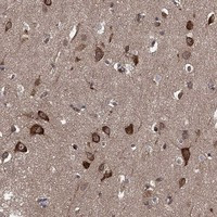 HABP4 Antibody in Immunohistochemistry (Paraffin) (IHC (P))