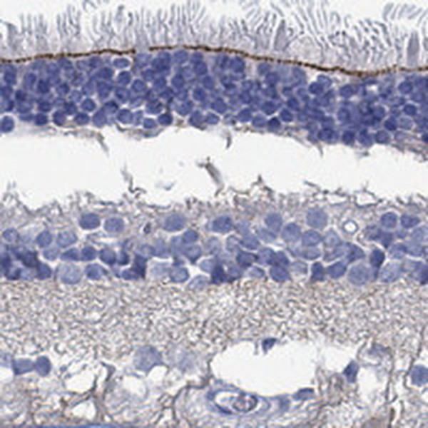 TMEM221 Antibody in Immunohistochemistry (Paraffin) (IHC (P))