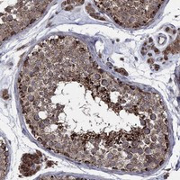 RNF19B Antibody in Immunohistochemistry (Paraffin) (IHC (P))