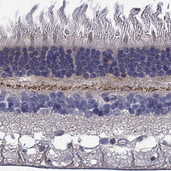 EGFLAM Antibody in Immunohistochemistry (Paraffin) (IHC (P))