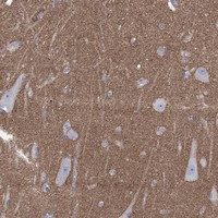 SHISA4 Antibody in Immunohistochemistry (Paraffin) (IHC (P))