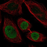 ZNF354C Antibody in Immunocytochemistry (ICC/IF)