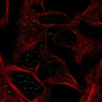 ABHD17A Antibody in Immunocytochemistry (ICC/IF)