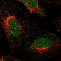 SFMBT2 Antibody in Immunocytochemistry (ICC/IF)
