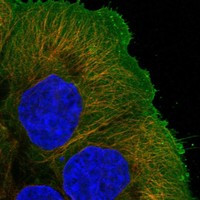 GPRIN2 Antibody in Immunocytochemistry (ICC/IF)