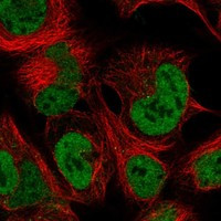 HOXA10 Antibody in Immunocytochemistry (ICC/IF)