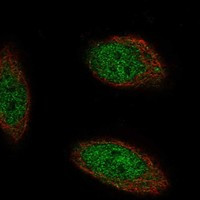 TMEM267 Antibody in Immunocytochemistry (ICC/IF)