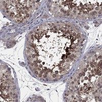 MEA1 Antibody in Immunohistochemistry (Paraffin) (IHC (P))