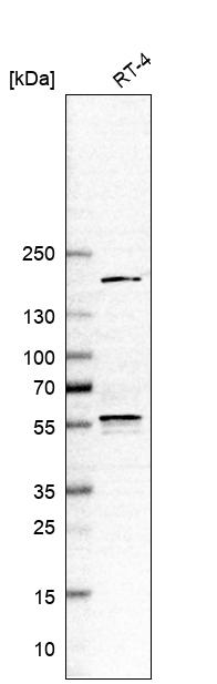 ETV3 Antibody in Western Blot (WB)
