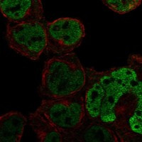 C1orf226 Antibody in Immunocytochemistry (ICC/IF)
