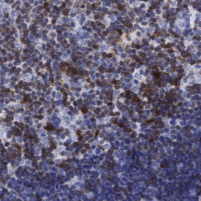 SH2D2A Antibody in Immunohistochemistry (Paraffin) (IHC (P))