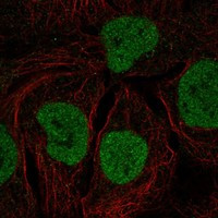 l-Myc Antibody in Immunocytochemistry (ICC/IF)