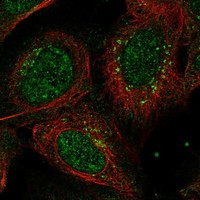ANKRD40 Antibody in Immunocytochemistry (ICC/IF)