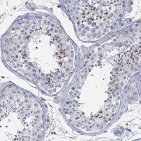 CCDC176 Antibody in Immunohistochemistry (Paraffin) (IHC (P))