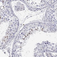C10orf90 Antibody in Immunohistochemistry (Paraffin) (IHC (P))